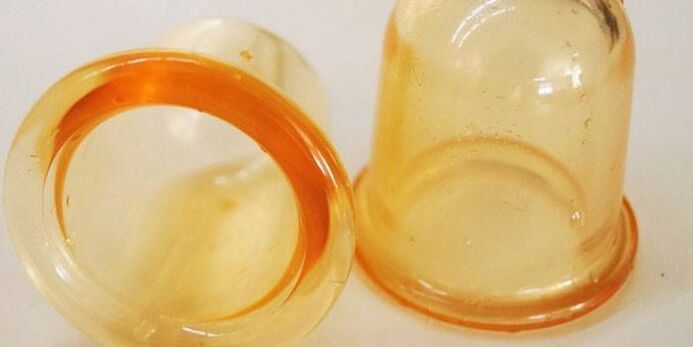 cups to treat prostatitis