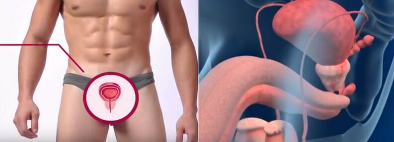 Prostatitis in men can be recognized by certain signs